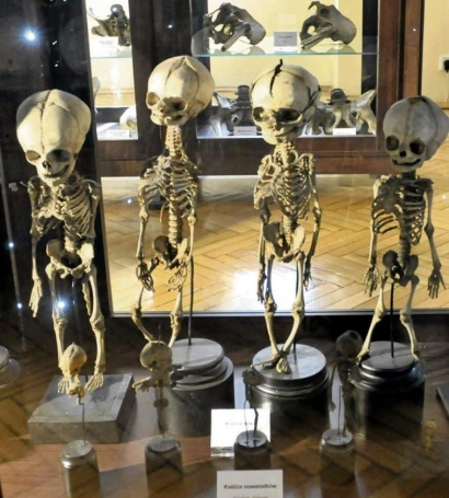 Zdjęcie nr 4 z galerii Wizyta w Muzeum Katedry i Zakładu Anatomii Uniwersytetu Jagiellońskiego